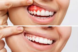 Periodontics